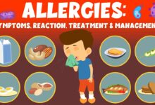 What Are Allergies Symptoms Causes Diagnosis Treatment and Prevention