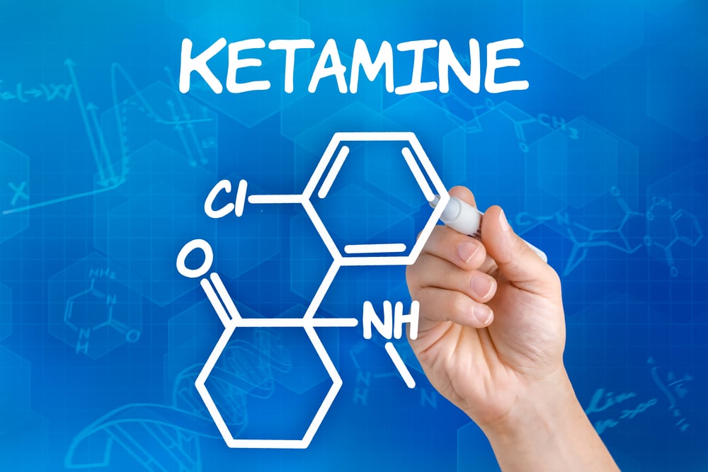 What Is Ketamine Treatment Therapy A Detailed Scientific Guide